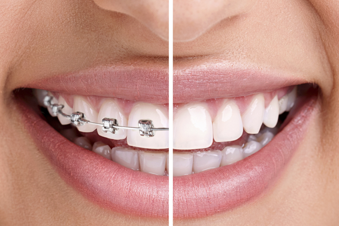 En İyi Ortodontist